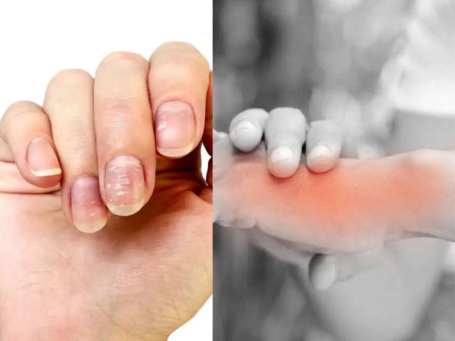 Health Tips-&nbsp;शरीर में कैल्शियम की कमी होने पर दिखाई देते हैं ये लक्षण, रहे सावधान