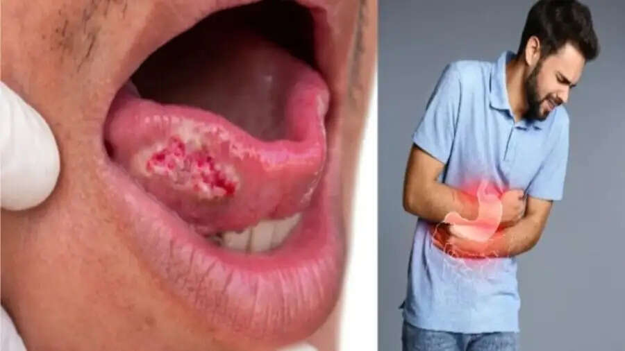 Health Tips-&nbsp;कैंसर की पहचान के कराए ये टेस्ट, जानिए इनके बारे में