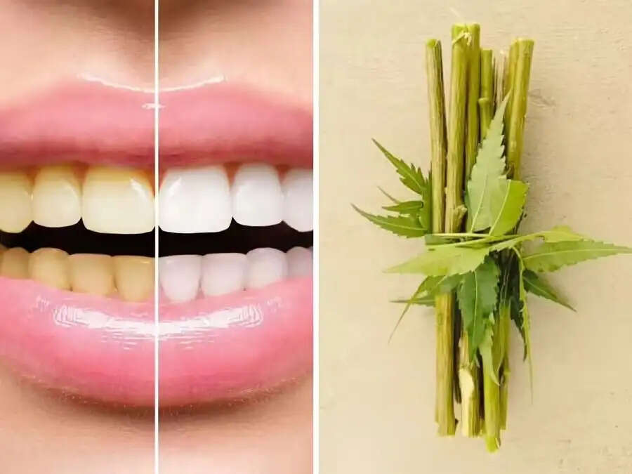 Teeth Care Tips-&nbsp;नीम की दातून ना केवल दांतों को स्वस्थ रखती हैं, बल्कि इन बीमारियों से भी करती हैं रक्षा