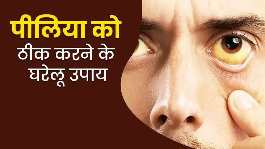 Health Tips-पीलिया हो गया हैं, तो अपनाए ये स्वास्थ नुस्खें