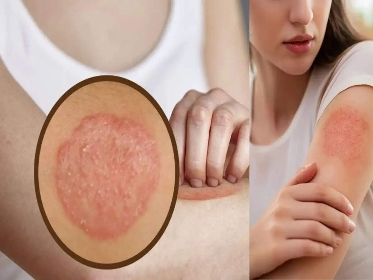 Skin Care Tips- क्या आपको खुजली हो गई हैं, राहत पाने के लिए अपनाएं ये तरीके