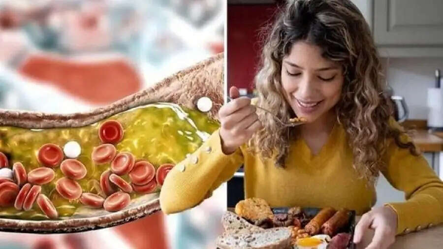Health Tips-&nbsp;शरीर से खराब कोलेस्ट्रॉल को निकाल फैंकते ये फूड, ऐसे करें इनका सेवन