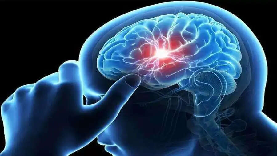 Health Tips-  ब्रेन स्ट्रोक से पहले दिखाई देते हैं ये लक्षण, जानिए इनके बारे में