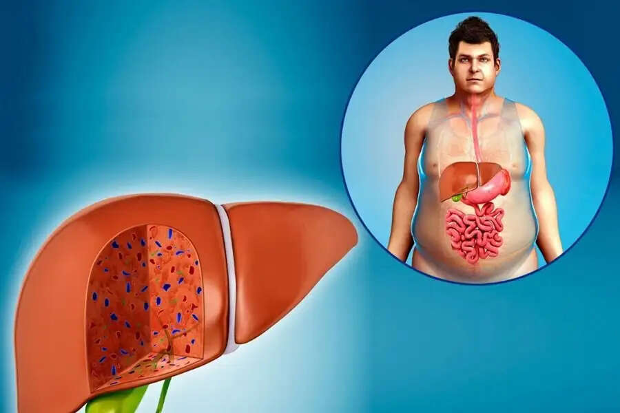 Health Tips-&nbsp;लिवर से जुड़े इन संकेतों को भूलकर भी ना करें इंग्नौर, स्वास्थ्य के लिए हैं हानिकारक