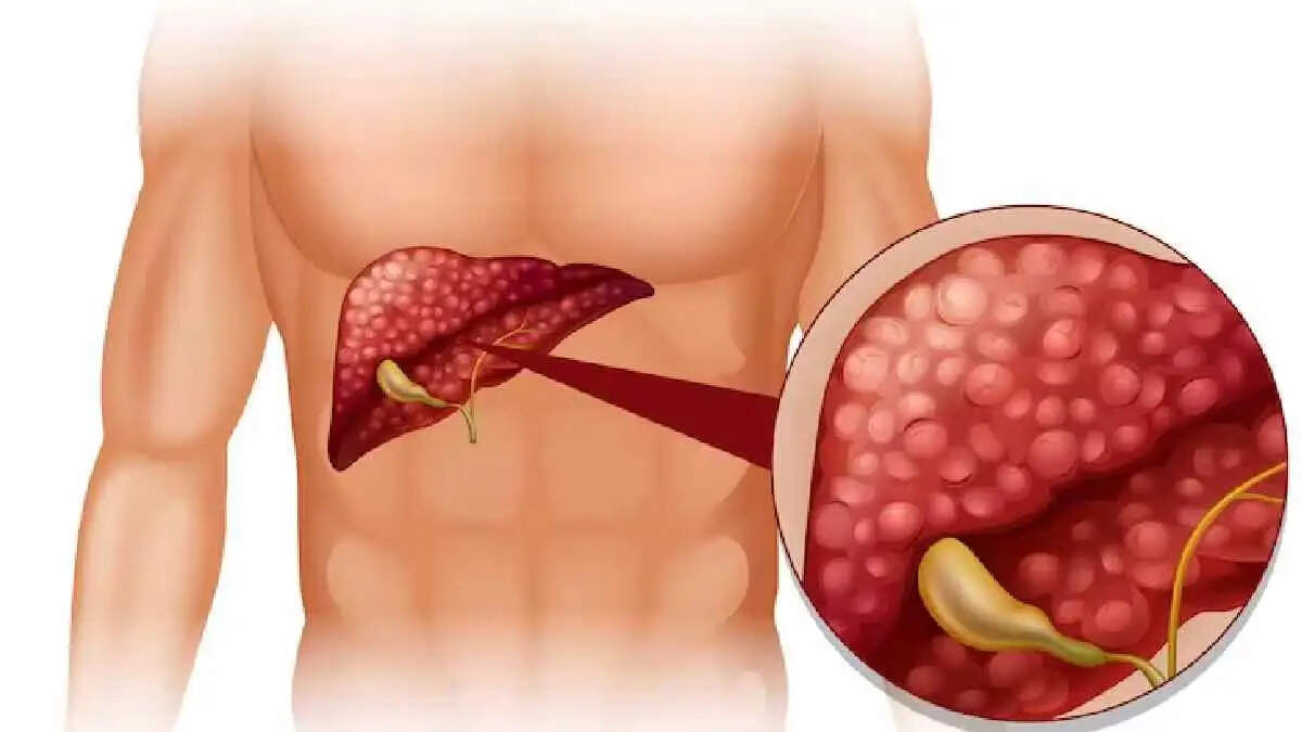 Health Tips- क्या आपके लिवर में जम गया हैं कचरा, डिटॉक्स करने के लिए इन चीजों का करें सेवन