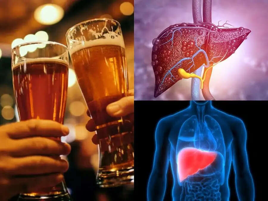 Health Tips- आखिर क्यों बीयर पीने से निकलने लगता हैं पेट, जानिए इसकी वजह