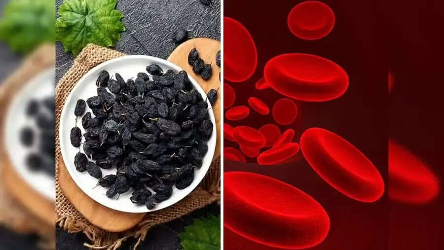Health Tips-&nbsp;इन लोगो को भूलकर भी नहीं खानी चाहिए काली किशमिश, जानिए इसकी वजह