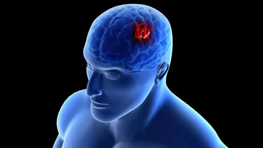 Health Tips-&nbsp;ब्रेन ट्यूमर से जुड़े हैं ये मिथक, जिनसे लोग जीने की आस छोड़ देते हैं