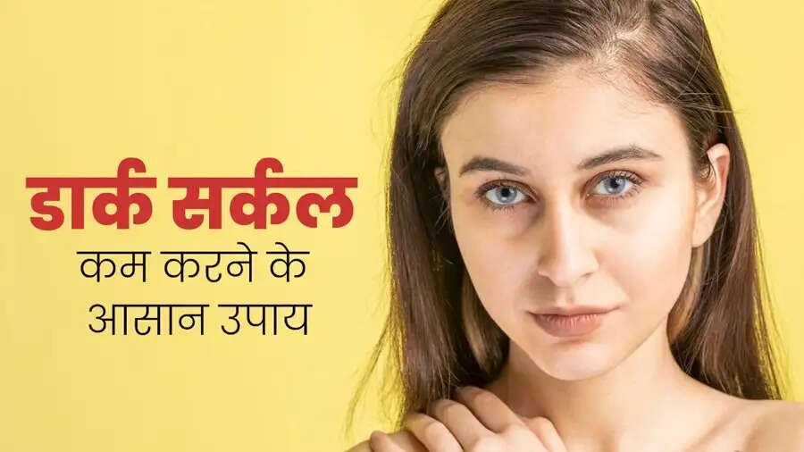 Eye Care Tips-&nbsp;क्या आपकी आंखों के नीचे काले घेरे हो पड़ गए हैं, हाटाने के लिए अपनाएं ये तरीके