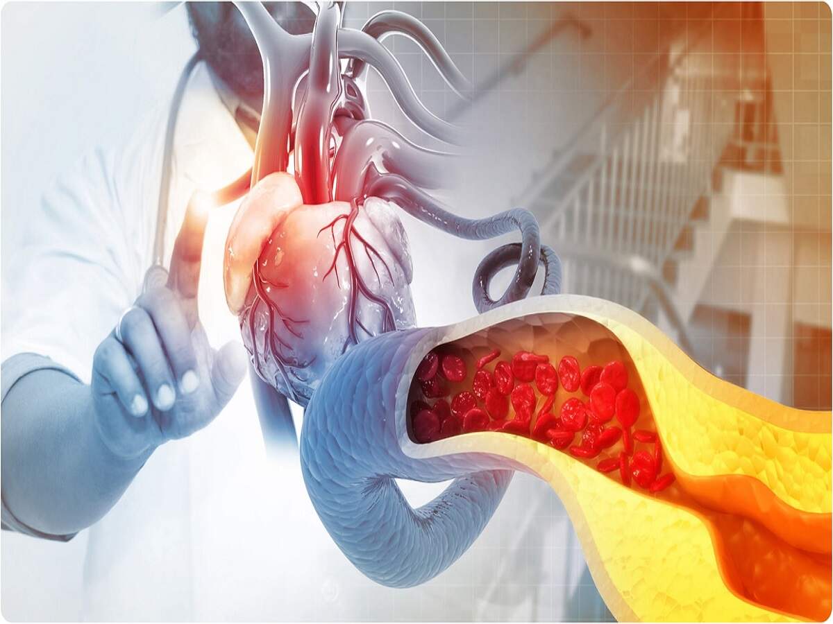 Health Tips: Can cholesterol levels rise even in thin people? Find out the full details.
