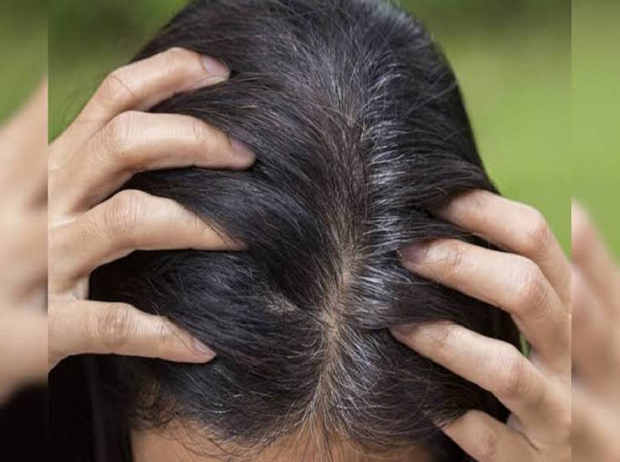 Hair Care Tips: Have your hair turned grey prematurely? Learn how to make it black again.