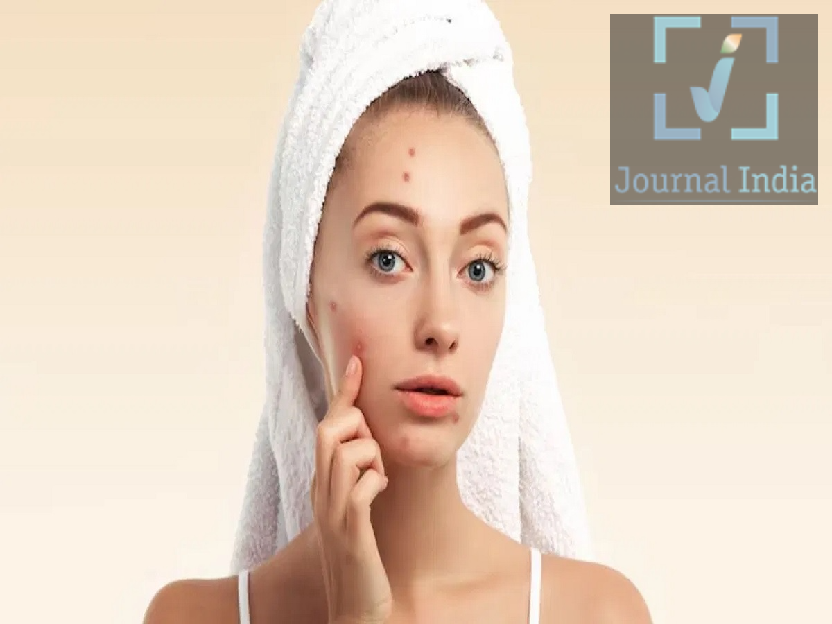13 Skin Care Tips- क्या आपको पता हैं पिंपल्स क्यों निकलते हैं, आइए जानें दोस्तो पिंपल्स आज के युवाओं में सबसे ज्यादा दिखने वाली प्रॉब्लम हैं, ये आमतौर पर तब होते हैं जब त्वचा के रोमछिद्र (pores) ज़्यादा तेल, मृत त्वचा कोशिकाओं और अन्य अशुद्धियों से बंद हो जाते हैं। हार्मोनल बदलाव, तनाव और कुछ स्किनकेयर आदतें मुँहासों को और खराब कर सकती हैं, लेकिन क्या आपको पता हैं मुंहासे क्यों होते हैं, चलिए जानते हैं इनकी वजह 1. त्वचा के रोमछिद्रों का बंद होना मुँहासे अक्सर तब शुरू होते हैं जब बालों के रोम (hair follicles) या त्वचा के रोमछिद्र ज़्यादा तेल और मृत त्वचा कोशिकाओं से बंद हो जाते हैं। इस रुकावट के कारण पिंपल्स, ब्लैकहेड्स या व्हाइटहेड्स हो सकते हैं। 2. ज़्यादा तेल बनना जब त्वचा बहुत ज़्यादा सीबम या प्राकृतिक तेल बनाती है, तो रोमछिद्रों के बंद होने की संभावना बढ़ जाती है। इसलिए, जिनकी त्वचा स्वाभाविक रूप से तैलीय (oily) होती है, उन्हें मुँहासे होने का खतरा ज़्यादा हो सकता है। 3. बैक्टीरिया और सूजन बंद रोमछिद्रों के अंदर बैक्टीरिया पनप सकते हैं और सूजन का कारण बन सकते हैं। इससे लाल, सूजे हुए या दर्दनाक पिंपल्स हो सकते हैं। 4. हार्मोनल बदलाव हार्मोनल उतार-चढ़ाव मुँहासों का एक मुख्य कारण हैं। यही कारण है कि किशोरावस्था और युवावस्था में मुँहासे ज़्यादा आम होते हैं।  5. तनाव और खराब नींद कुछ लोगों में तनाव और अपर्याप्त नींद मुँहासों को बढ़ा सकती है। एक अच्छी नींद की दिनचर्या बनाए रखना और तनाव को प्रबंधित करना स्किनकेयर रूटीन के हिस्से के रूप में मददगार हो सकता है।