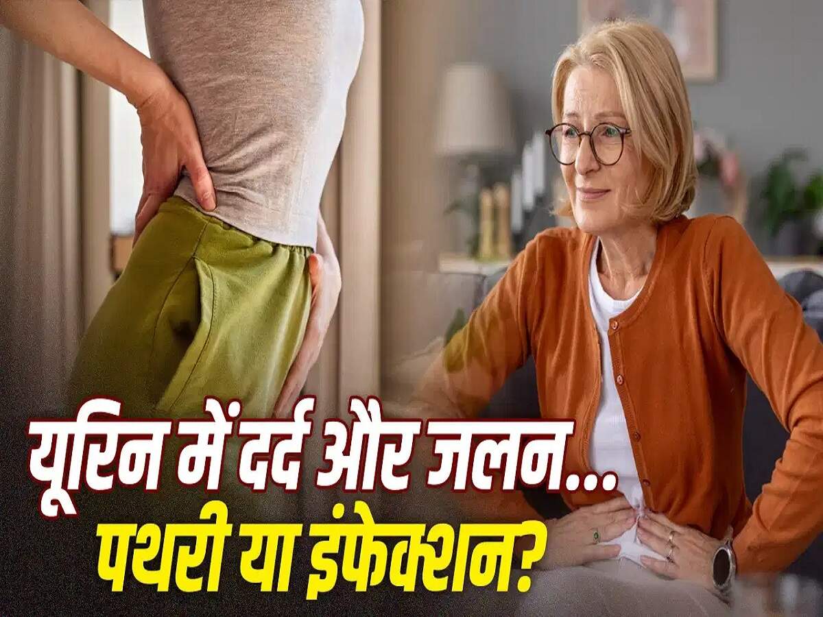 Health Tips: Kidney stones or a urinary infection? Let's understand the difference between the two.