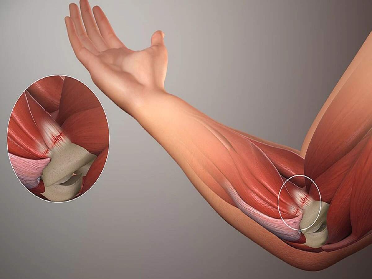 Joint Pain Tips: Does joint pain worsen during the monsoon? Find out the reason.