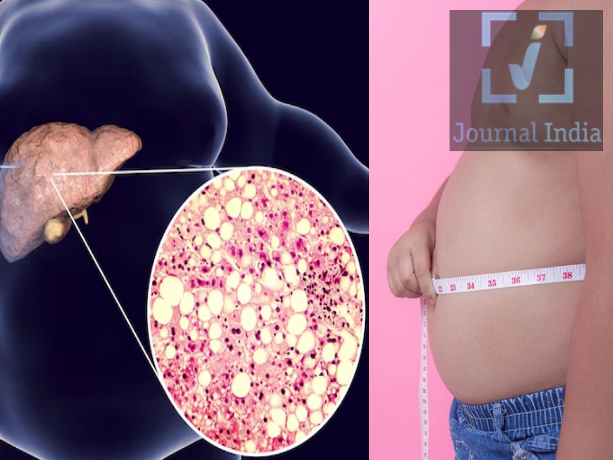 Fatty Liver Symptoms: फैटी लिवर के ये 5 संकेत, पुरुष न करें नजरअंदाज, जानिए इनके बारे में दोस्तो आज के युवा अपना अधिकांश समय मोबाईल फोन, 10-12 घंटे की डेस्क जॉब आदि पर बैठकर बिताते हैं, इसके अलावा गलत खान-पान, शारीरिक रूप से निष्क्रिय जीवनशैली, मोटापा और मेटाबॉलिक समस्याएं उत्पन्न हो जाती हैं, एक सबसे आम बीमारी फैटी लिवर दो पुरुषों में आम होती जा रही है। यह स्थिति तब पैदा होती है जब लिवर की कोशिकाओं में बहुत अधिक फैट जमा हो जाता है। फैटी लिवर के कोई खास लक्षण दिखाई नहीं देते, जिससे बिना मेडिकल टेस्ट के इसका पता लगाना मुश्किल हो जाता है। लेकिन कुछ संकेंत हैं जिनकी मदद से आप इनका पता कर सकते हैं-  1. लगातार थकान महसूस होना  पर्याप्त नींद लेने के बाद भी थकान महसूस होने के कई कारण हो सकते हैं, जैसे तनाव, शरीर में पोषक तत्वों की कमी या कोई अन्य मेडिकल समस्या। लिवर की बीमारी वाले लोगों में अक्सर लगातार थकान बनी रह सकती है।  2. पेट के ऊपरी दाहिने हिस्से में बेचैनी लिवर पेट के ऊपरी दाहिने हिस्से में स्थित होता है। फैटी लिवर से पीड़ित कुछ लोगों को इस हिस्से में हल्की बेचैनी, दबाव या भारीपन महसूस हो सकता है।  3. पेट की चर्बी बढ़ना पेट के आसपास बहुत अधिक फैट, मोटापा और इंसुलिन रेजिस्टेंस, फैटी लिवर के प्रमुख जोखिम कारक हैं। अगर आपकी कमर का घेरा बढ़ रहा है, तो अपने खान-पान और शारीरिक गतिविधियों में सुधार करने पर ध्यान दें।  4. कमजोरी और ऊर्जा की कमी लगातार कमजोरी, सुस्ती या रोजमर्रा के काम करने में कठिनाई होना कई स्वास्थ्य समस्याओं से जुड़ा हो सकता है, जिसमें लिवर की बीमारी भी शामिल है। मेडिकल जांच से इसके असली कारण का पता लगाने में मदद मिल सकती है। 5. भूख कम लगना और जी मिचलाना बार-बार जी मिचलाना, भूख कम लगना या खाना खाने के बाद बेचैनी महसूस होना, पाचन या लिवर से जुड़ी कई समस्याओं के लक्षण हो सकते हैं। अगर ये लक्षण लगातार बने रहते हैं, तो डॉक्टर से सलाह लें।  फैटी लिवर के खतरे को कैसे कम करें संतुलित आहार लें और मीठे पेय पदार्थों, ज्यादा चीनी और अधिक कैलोरी वाले खाद्य पदार्थों का सेवन सीमित करें। नियमित रूप से टहलें और अपनी शारीरिक क्षमता के अनुसार व्यायाम करें। अगर आपका वजन ज्यादा है, तो धीरे-धीरे और लंबे समय तक कायम रहने वाले तरीके से वजन कम करने का लक्ष्य रखें। डायबिटीज और हाई कोलेस्ट्रॉल को कंट्रोल में रखें। शराब से बचें, खासकर अगर आपको लिवर की कोई बीमारी है। डॉक्टर की सलाह के बिना लिवर साफ करने वाले सप्लीमेंट न लें।