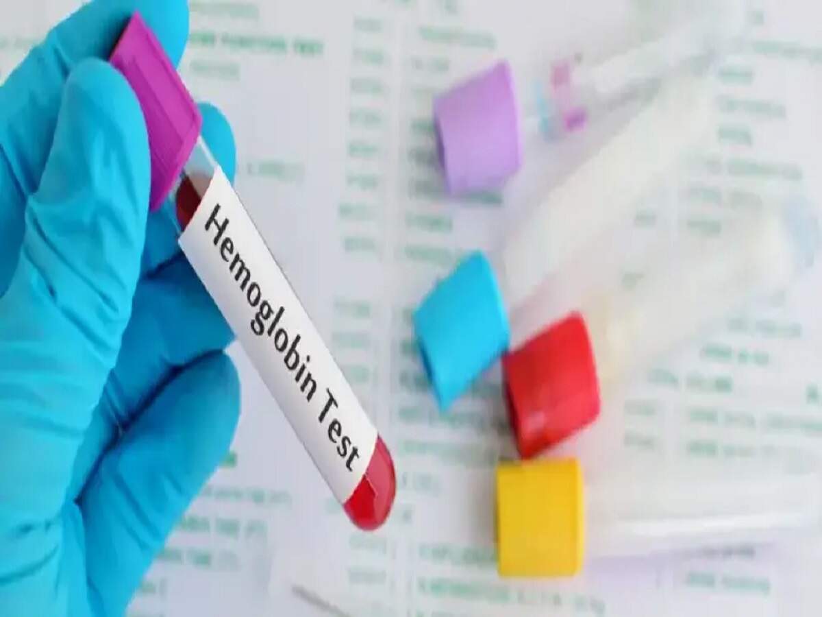 Health Tips – Can't understand your hemoglobin report? Here's how to check it.