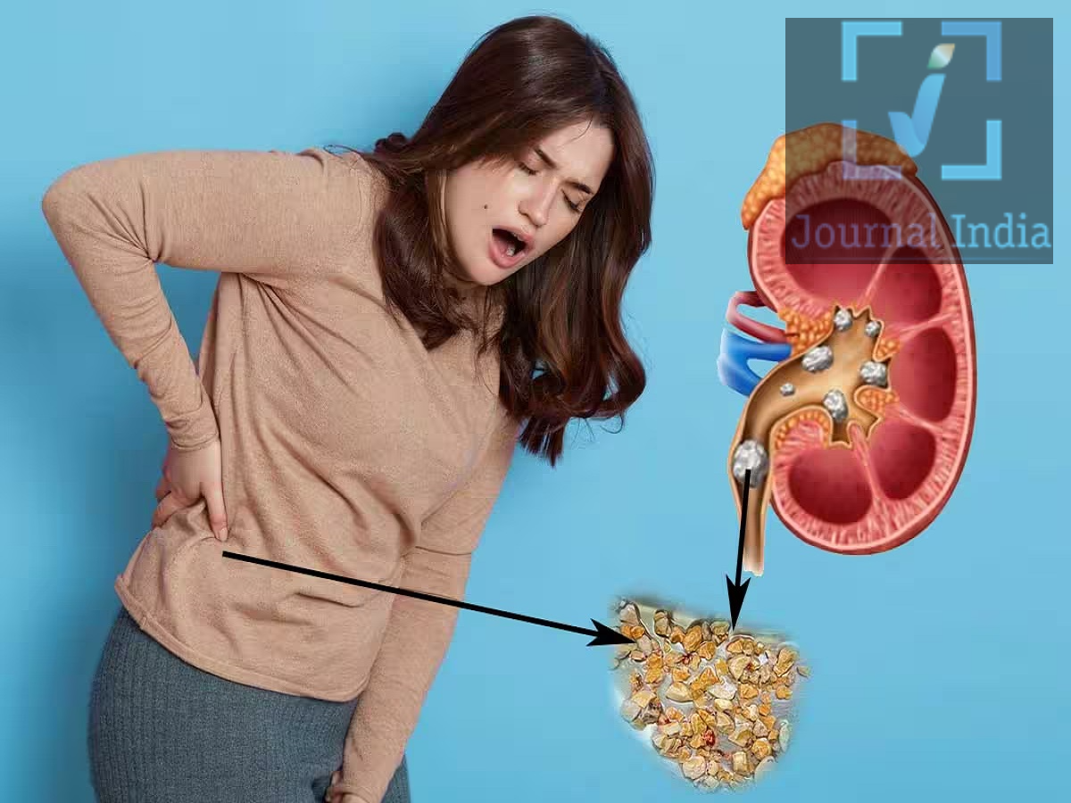 Health Tips: Kidney stones or a urinary infection? Let's understand the difference between the two.