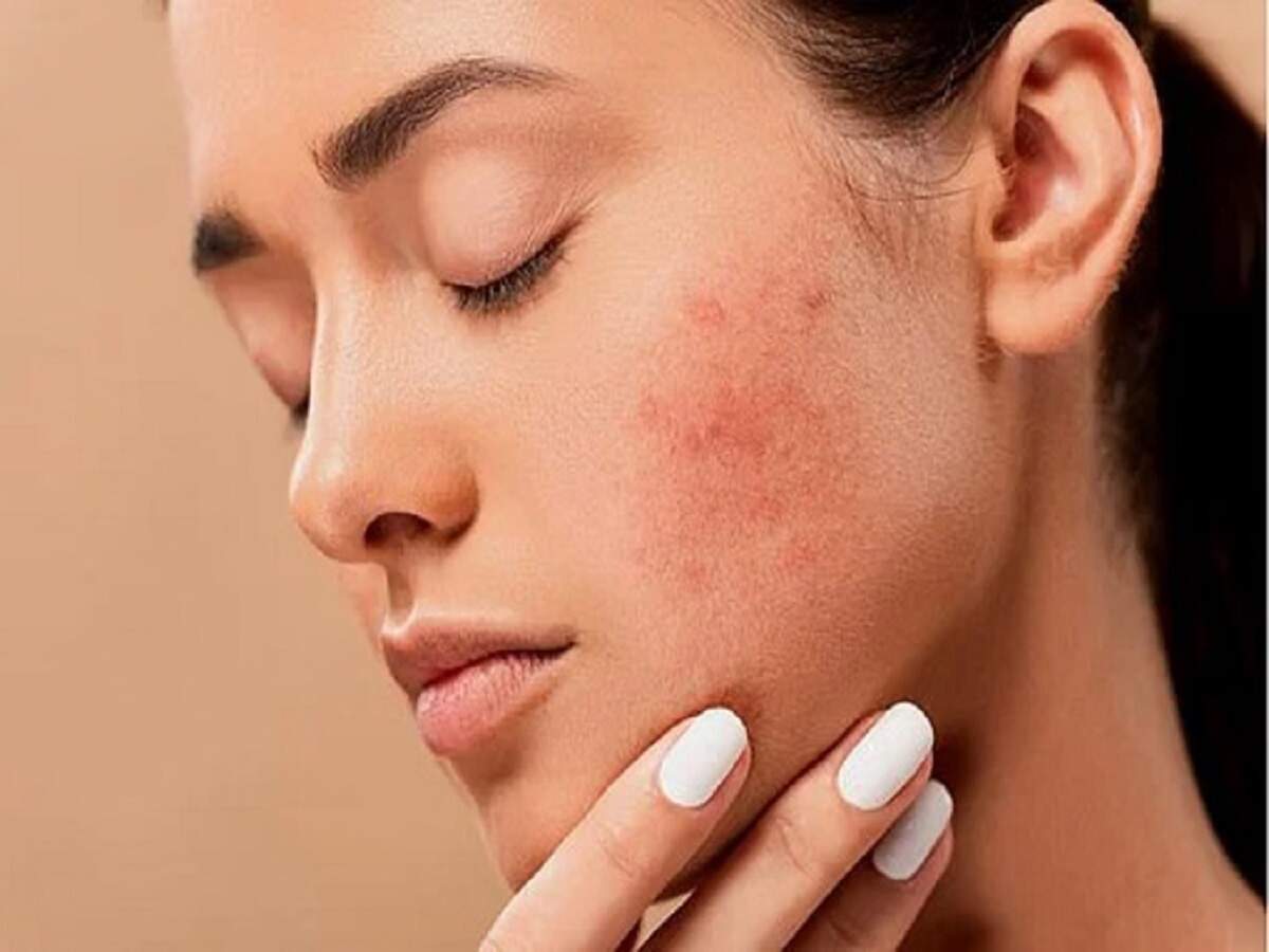 Skin Care Tips: Persistent changes in your skin could indicate liver damage.
