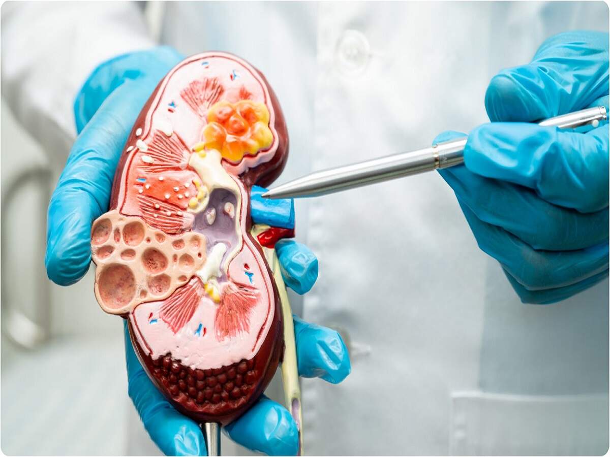 Health Tips: Does sitting for long periods have a negative impact on the kidneys? Let's find out.