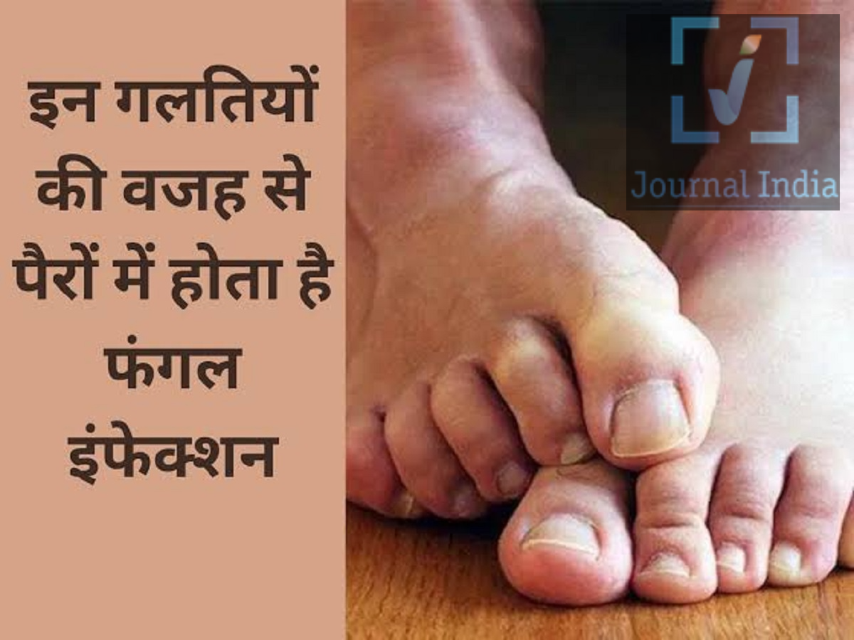 Fungal Infection &ndash; Mistakes made during the monsoon can lead to fungal infections; find out how.