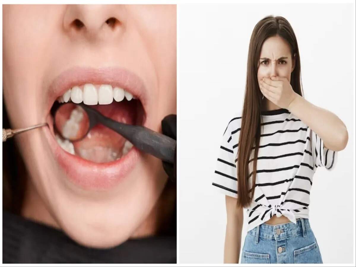 Dental Care Tips: Do your gums bleed? Could it be a sign of a serious illness?