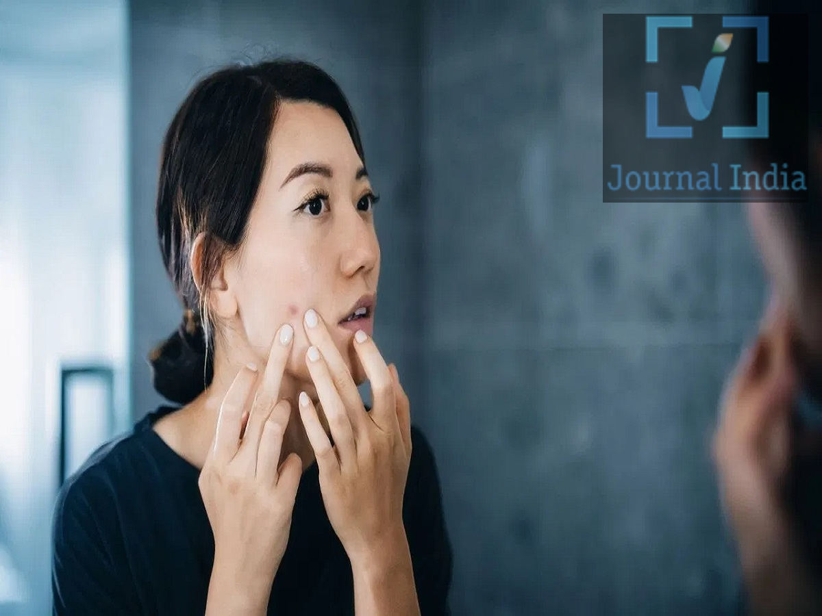 Acne Tips &ndash; Your daily mistakes could trigger acne; find out what they are.