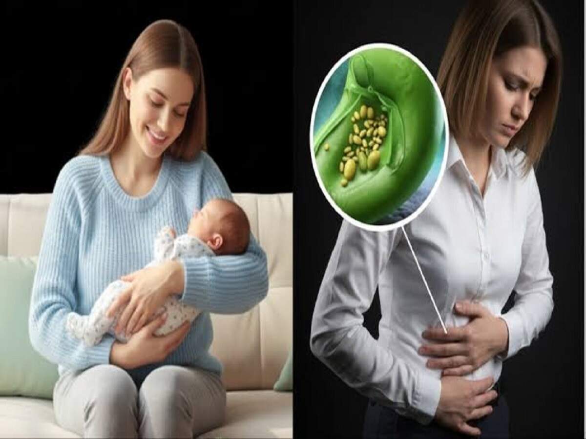 Health Tips: Consuming desi ghee can lead to gallstones—find out what experts say.