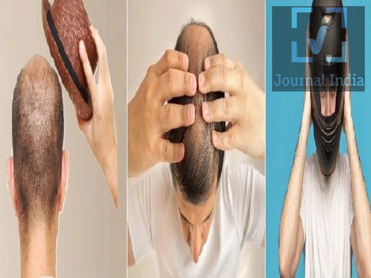 Hair Care Tips- गंदा हेलमेट पहनने से हो सकती हैं स्कैल्प एलर्जी, जानिए विशेषज्ञों की राय दोस्तो भारत में बाइक चलाते समय हेलमेट पहनना बहुत जरूरी हैं, न केवल कानून की वजह से बल्कि अपनी सुरक्षा के लिए भी, लेकिन क्या आपने सोचा कि एक ही हेलमेट कई सालों से यूज कर रहे हैं, तो वो क्या खराब नहीं हुआ होगा, इससे आपके बालों और स्कैल्प पर बुरा असर पड़ सकता है? हेलमेट के अंदर पसीना, तेल, धूल और त्वचा से जुड़े सूक्ष्मजीव जमा हो सकते हैं। ऐसे में लगातार इस्तेमाल से स्कैल्प में कुछ समस्याएं पैदा हो सकती हैं। हेलमेट पहनने से स्कैल्प में क्यों बढ़ सकती है नमी? हेलमेट पहनने के बाद सिर के आसपास हवा का प्रवाह कम हो जाता है। खासकर गर्मी और उमस के मौसम में सिर पर ज्यादा पसीना आ सकता है। यह नमी हेलमेट की अंदरूनी लाइनिंग में भी जमा हो सकती है। लगातार नमी और पसीने वाला वातावरण बैक्टीरिया और फंगस जैसे सूक्ष्मजीवों के बढ़ने के लिए अनुकूल हो सकता है। हालांकि, सिर्फ गंदा हेलमेट ही किसी संक्रमण का एकमात्र कारण नहीं होता। स्कैल्प की अपनी प्राकृतिक सुरक्षा प्रणाली और माइक्रोबायोम भी महत्वपूर्ण भूमिका निभाते हैं। खुजली और जलन जैसी समस्याएं हो सकती हैं खुजली जलन या इरिटेशन लाल चकत्ते छोटे दाने या फुंसियां फॉलिकुलाइटिस डैंड्रफ या सेबोरिक डर्मेटाइटिस जैसी समस्याएं हो सकती हैं। गर्म और नम वातावरण कुछ प्रकार के यीस्ट की वृद्धि को भी बढ़ावा दे सकता है, जिससे पहले से मौजूद स्कैल्प की समस्याएं और परेशान कर सकती हैं। क्या गंदे हेलमेट से फंगल इंफेक्शन हो सकता है? कुछ त्वचा संबंधी संक्रमण संक्रमित व्यक्ति या उसकी व्यक्तिगत वस्तुओं के संपर्क से फैल सकते हैं। Tinea capitis (स्कैल्प रिंगवर्म) इसका एक उदाहरण है। हालांकि यह समस्या बच्चों में अधिक देखी जाती है और हर तरह की खुजली या बाल झड़ने की समस्या को इस संक्रमण से जोड़ना सही नहीं है। इसलिए हेलमेट को संक्रमण का निश्चित कारण मानने के बजाय उसकी स्वच्छता और व्यक्तिगत सुरक्षा पर ध्यान देना जरूरी है।