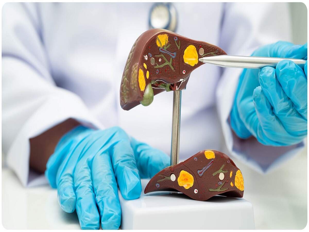 Health Tips: These early symptoms appear with a fatty liver; ignoring them can be life-threatening.