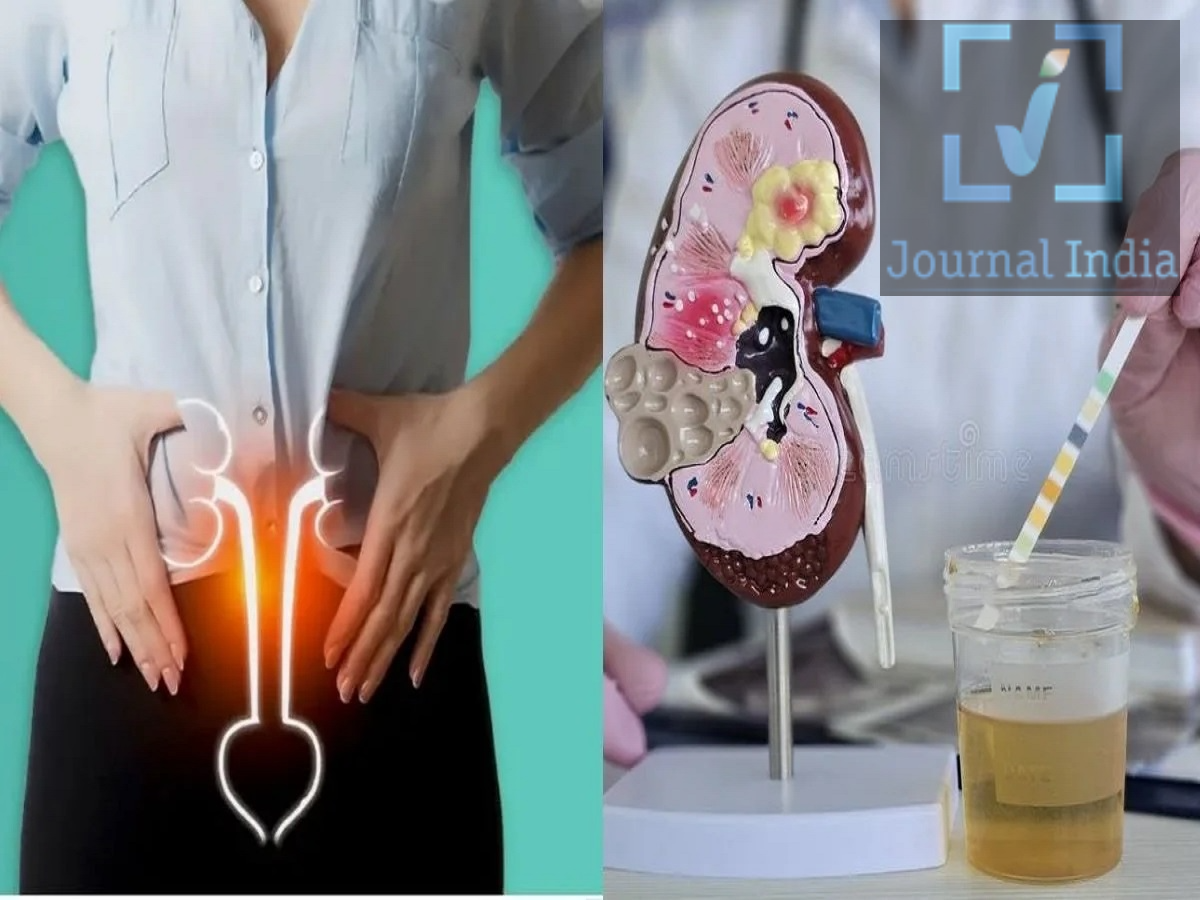 Health Tips- पेशाब में दिख रहे हैं ये बदलाव, तो हो सकता हैं ब्लैडर कैंसर का संकेत दोस्तो शरीर की अंदरूनी बीमारियों का संकेत आपके शरीर के बाहरी अंग बता देते ते हैं, ऐसे में अगर आपके पेशाब में अचानक कुछ बदलाव दिखें जैसे पेशाब करने की इच्छा होना, या पेशाब करते समय जलन महसूस होना अक्सर डिहाइड्रेशन या यूरिनरी ट्रैक्ट इन्फेक्शन (UTI) से जुड़े होते हैं। हालाँकि, कुछ मामलों में, ये लक्षण किसी अंदरूनी बीमारी का संकेत भी हो सकते हैं, जिसमें ब्लैडर कैंसर भी शामिल है। आइए जानते हैं इसके लक्षणों के बारे में-  1. क्या रूटीन यूरिन टेस्ट से ब्लैडर कैंसर का पता चल सकता है? एक रूटीन यूरिन टेस्ट ऐसी असामान्यताओं का पता लगा सकता है जो डॉक्टर को ब्लैडर कैंसर की संभावना की जांच करने के लिए प्रेरित कर सकती हैं। हालाँकि, अलग-अलग टेस्ट के अलग-अलग मकसद होते हैं, और हर यूरिन टेस्ट कैंसर कोशिकाओं का पता नहीं लगा सकता। डॉक्टर व्यक्ति के लक्षणों और मेडिकल हिस्ट्री के आधार पर नीचे दिए गए टेस्ट की सलाह दे सकते हैं। - यूरिनालिसिस (Urinalysis): इस टेस्ट में पेशाब में खून, इन्फेक्शन के संकेत और अन्य असामान्यताओं की जांच की जाती है। यह लाल रक्त कोशिकाओं (red blood cells) का पता लगा सकता है, भले ही नंगी आँखों से पेशाब सामान्य दिखे। - यूरिन साइटोलॉजी (Urine Cytology): इस टेस्ट में असामान्य या संभावित कैंसर वाली कोशिकाओं का पता लगाने के लिए यूरिन सैंपल में कोशिकाओं की जांच की जाती है। यह कुछ खास हाई-ग्रेड ब्लैडर कैंसर का पता लगाने के लिए बहुत उपयोगी हो सकता है, हालाँकि यह कुछ कैंसर से चूक भी सकता है। - यूरिन ट्यूमर मार्कर टेस्ट (Urine Tumour Marker Tests): खास टेस्ट ब्लैडर कैंसर से जुड़े पदार्थों या मॉलिक्यूलर बदलावों का पता लगाते हैं। डॉक्टर कुछ खास मामलों में, जैसे कि कुछ फॉलो-अप स्थितियों में, इनकी सलाह दे सकते हैं। असामान्य यूरिन टेस्ट का मतलब यह नहीं है कि व्यक्ति को कैंसर है। इसी तरह, सामान्य परिणाम का मतलब हमेशा यह नहीं होता कि ब्लैडर कैंसर नहीं है, अगर लक्षण या अन्य जांच के नतीजे चिंताजनक बने हुए हैं। 2. पेशाब में कौन से बदलाव ब्लैडर कैंसर का संकेत हो सकते हैं? ब्लैडर कैंसर के कारण पेशाब से जुड़े कई लक्षण हो सकते हैं। हालाँकि, ये लक्षण इन्फेक्शन, किडनी स्टोन या अन्य मेडिकल स्थितियों के कारण भी हो सकते हैं। महत्वपूर्ण चेतावनी संकेतों में शामिल हैं: - पेशाब में खून आना: पेशाब गुलाबी, लाल या भूरे रंग का दिख सकता है। कभी-कभी, खून इतनी कम मात्रा में होता है कि इसका पता सिर्फ़ लैब टेस्ट से ही चल पाता है। - बार-बार पेशाब आना: सामान्य से ज़्यादा बार पेशाब करने की ज़रूरत महसूस होना ब्लैडर में जलन या पेशाब से जुड़ी दूसरी समस्याओं का संकेत हो सकता है। - अचानक और तुरंत पेशाब करने की ज़रूरत: बार-बार यह महसूस होना कि आपको तुरंत पेशाब करना है, भले ही ब्लैडर भरा न हो, अगर यह समस्या बनी रहती है तो डॉक्टर को दिखाना चाहिए। - पेशाब करते समय जलन या दर्द: यह लक्षण आमतौर पर UTI से जुड़ा होता है, लेकिन लगातार या बिना किसी स्पष्ट कारण के होने वाली परेशानी की भी जांच करवानी चाहिए। - पेशाब करने में कठिनाई: पेशाब की धार में बदलाव या पेशाब करने में मुश्किल के कई कारण हो सकते हैं और इसकी जांच किसी हेल्थकेयर प्रोफेशनल से करवानी चाहिए। सिर्फ़ इन लक्षणों के आधार पर कैंसर का पता नहीं लगाया जा सकता। मेडिकल जांच के ज़रिए इनके असली कारण का पता लगाना ज़रूरी है। 3. पेशाब में खून आना एक ज़रूरी चेतावनी का संकेत क्यों है? शरीर से बाहर निकलने से पहले, किडनी से बनने वाला पेशाब ब्लैडर में जमा होता है। जब ब्लैडर की परत में ट्यूमर बनता है, तो यह छोटी रक्त वाहिकाओं को नुकसान पहुँचा सकता है और ब्लीडिंग का कारण बन सकता है। पेशाब में खून आने की मेडिकल स्थिति को 'हेमेटुरिया' (hematuria) कहते हैं। यह आम तौर पर दो तरह का होता है: - दिखाई देने वाला हेमेटुरिया (Visible hematuria): पेशाब में खून दिखाई दे सकता है, जो गुलाबी, लाल या भूरे रंग का हो सकता है। - माइक्रोस्कोपिक हेमेटुरिया (Microscopic hematuria): खून मौजूद होता है लेकिन लैब टेस्ट के बिना दिखाई नहीं देता। एक ज़रूरी बात यह है कि ब्लीडिंग कभी-कभी हो सकती है। हो सकता है कि किसी व्यक्ति को एक बार पेशाब में खून दिखे और उसके बाद सामान्य रंग का पेशाब आए। इसका मतलब यह नहीं है कि समस्या खत्म हो गई है। 4. ब्लैडर कैंसर का ज़्यादा खतरा किसे होता है? - धूम्रपान: तंबाकू का इस्तेमाल ब्लैडर कैंसर का एक बड़ा जोखिम कारक है क्योंकि हानिकारक केमिकल ब्लडस्ट्रीम में प्रवेश कर सकते हैं और अंततः पेशाब के ज़रिए बाहर निकल सकते हैं। - बढ़ती उम्र: उम्र बढ़ने के साथ आम तौर पर खतरा बढ़ जाता है। - कुछ खास केमिकल के संपर्क में आना: काम के दौरान लंबे समय तक कुछ खास इंडस्ट्रियल केमिकल (जैसे डाई, रबर और केमिकल बनाने में इस्तेमाल होने वाले केमिकल) के संपर्क में रहने से खतरा बढ़ सकता है। - पहले ब्लैडर कैंसर होना: जिन लोगों को पहले ब्लैडर कैंसर हुआ हो, उन्हें रेगुलर फ़ॉलो-अप की ज़रूरत हो सकती है क्योंकि यह बीमारी दोबारा हो सकती है।