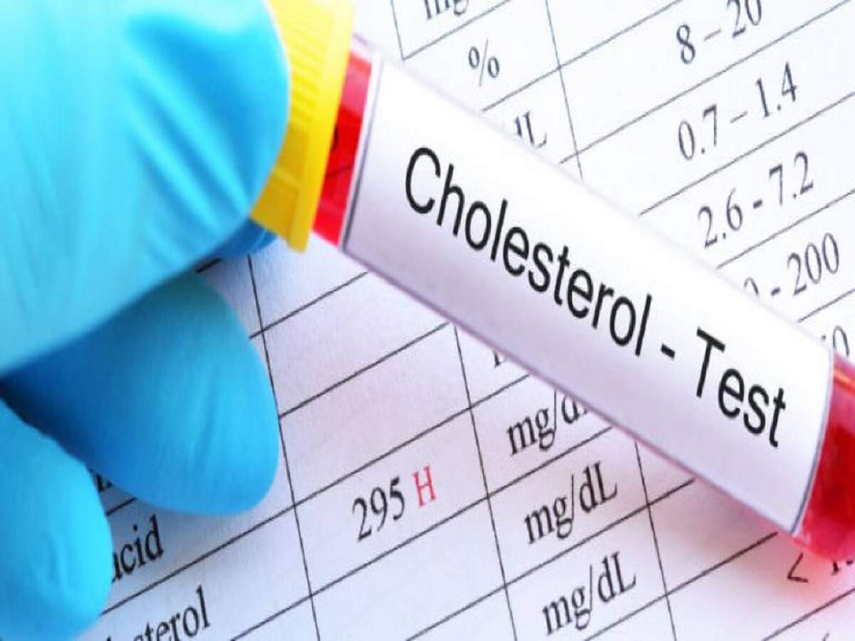 Health Tips: Can cholesterol levels rise even in thin people? Find out the full details.