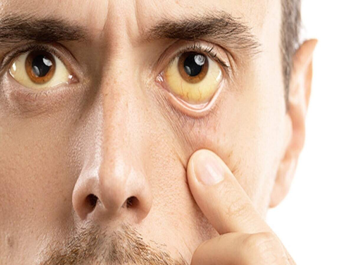 Health Tips: Vitamin B12 and D deficiencies are on the rise among Indians, leading to issues ranging from fatigue to bone pain.