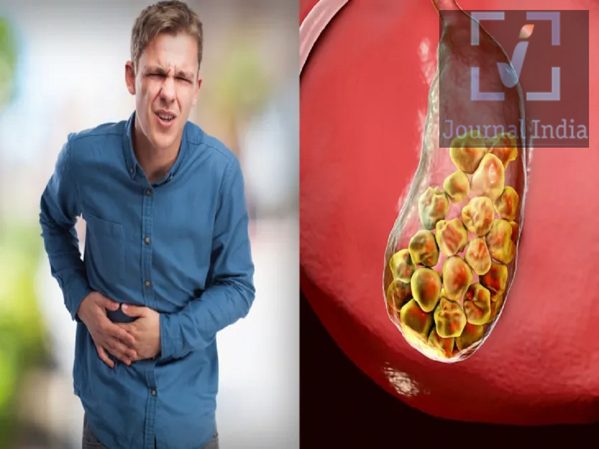 Health Tips- देसी घी के सेवन से हो जाती हैं गॉल ब्लैडर में पथरी, जानिए एक्सपर्ट्स क्या कहते हैं दोस्तो सदियों से ही देसी घी हमारे आहार का अहम हिस्सा हैं, जो हमें तंदूरुस्त रखता हैं, लेकिन क्या जरूरत से ज्यादा देसी घी खाना Gallstones यानी पित्त की पथरी का कारण बन सकता है? यह सवाल इसलिए महत्वपूर्ण है क्योंकि पित्त की पथरी बनने में शरीर में कोलेस्ट्रॉल और पित्त (Bile) का संतुलन अहम भूमिका निभाता है। देसी घी को पित्त की पथरी का सीधा कारण नहीं माना जा सकता, लेकिन इसका अत्यधिक सेवन कुछ ऐसे जोखिम बढ़ा सकता है जो इस समस्या को प्रभावित कर सकते हैं, आइए जानते हैं पूरी डिटेल्स कैसे बनती है पित्त की पथरी? पित्ताशय (Gallbladder) में बनने वाली ज्यादातर पथरियां कोलेस्ट्रॉल स्टोन होती हैं। जब पित्त में मौजूद अलग-अलग पदार्थों का संतुलन बिगड़ता है, तो कोलेस्ट्रॉल जमा होकर धीरे-धीरे पथरी का रूप ले सकता है। पित्त का मुख्य काम शरीर में वसा को पचाने में मदद करना है। इसलिए पित्ताशय और फैट के सेवन के बीच संबंध को समझना जरूरी है। क्या देसी घी सीधे पित्त की पथरी बनाता है? सिर्फ देसी घी खाने को पित्त की पथरी का सीधा कारण नहीं माना जा सकता। पित्त की पथरी तब बनती है जब पित्त में मौजूद विभिन्न पदार्थों का संतुलन बिगड़ जाता है। हालांकि, देसी घी में सैचुरेटेड फैट और कैलोरी की मात्रा अधिक होती है। अगर लंबे समय तक इसका जरूरत से ज्यादा सेवन किया जाए, तो: वजन बढ़ सकता है। शरीर में कोलेस्ट्रॉल का स्तर बढ़ सकता है। ज्यादा कैलोरी लेने से मोटापे का जोखिम बढ़ सकता है। ये सभी कारक पित्त की पथरी के जोखिम को प्रभावित कर सकते हैं। इसलिए देसी घी को पित्त की पथरी का अकेला कारण बताना सही नहीं है, लेकिन इसका अत्यधिक सेवन निश्चित रूप से नुकसानदायक हो सकता है। अगर पहले से पित्त की पथरी है तो सावधान रहें जिन लोगों को पहले से Gallstones की समस्या है, उन्हें बहुत ज्यादा फैट वाला भोजन खाने से परेशानी बढ़ सकती है। वसायुक्त भोजन खाने के बाद पित्ताशय सिकुड़ता है और पित्त को आंत में छोड़ता है। इस दौरान अगर कोई पथरी पित्त की नली में खिसककर रुकावट पैदा कर दे, तो अचानक तेज दर्द हो सकता है। इसलिए पित्त की पथरी वाले लोगों को देसी घी, तला-भुना और अत्यधिक वसायुक्त भोजन सीमित मात्रा में लेने की सलाह दी जाती है। इन लक्षणों को बिल्कुल नजरअंदाज न करें पेट के ऊपरी दाहिने हिस्से में तेज दर्द। दर्द का पीठ या दाहिने कंधे तक पहुंचना। बार-बार उल्टी होना। बुखार आना। आंखों या त्वचा का पीला पड़ना। खाना खाने के बाद पेट में तेज दर्द या असहजता। खासकर तेज दर्द के साथ बुखार, लगातार उल्टी या पीलिया जैसे लक्षण हों तो तुरंत चिकित्सकीय जांच करानी चाहिए। क्या पित्त की पथरी का संबंध कोलेस्ट्रॉल से है? खून में बढ़े हुए कोलेस्ट्रॉल या ट्राइग्लिसराइड्स और पित्त की पथरी बनने के बीच सीधा कारण-परिणाम संबंध हर मामले में स्थापित नहीं किया जा सकता। लेकिन शरीर में फैट मेटाबॉलिज्म, वजन और खान-पान जैसे कई कारक इस बीमारी के जोखिम को प्रभावित कर सकते हैं। कितना देसी घी खाना चाहिए? देसी घी पूरी तरह बंद करना हर व्यक्ति के लिए जरूरी नहीं है। लेकिन इसका सेवन संतुलित मात्रा में करना महत्वपूर्ण है। खासकर अगर आपको पहले से Gallstones, मोटापा, हाई कोलेस्ट्रॉल या पाचन संबंधी समस्या है, तो अपनी डाइट डॉक्टर या डाइटीशियन की सलाह के अनुसार तय करना बेहतर है।