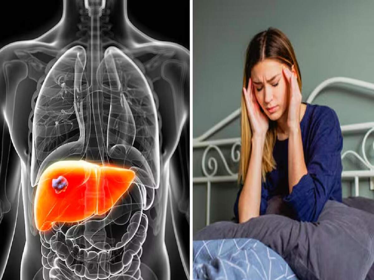 Health Tips: You can treat fatty liver without medication—let's find out how.