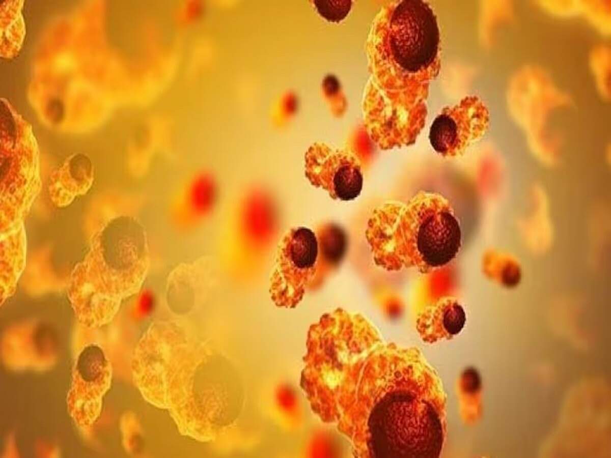 Health Tips: Risk of cancer exists between the ages of 20 and 30; do not ignore these signs.