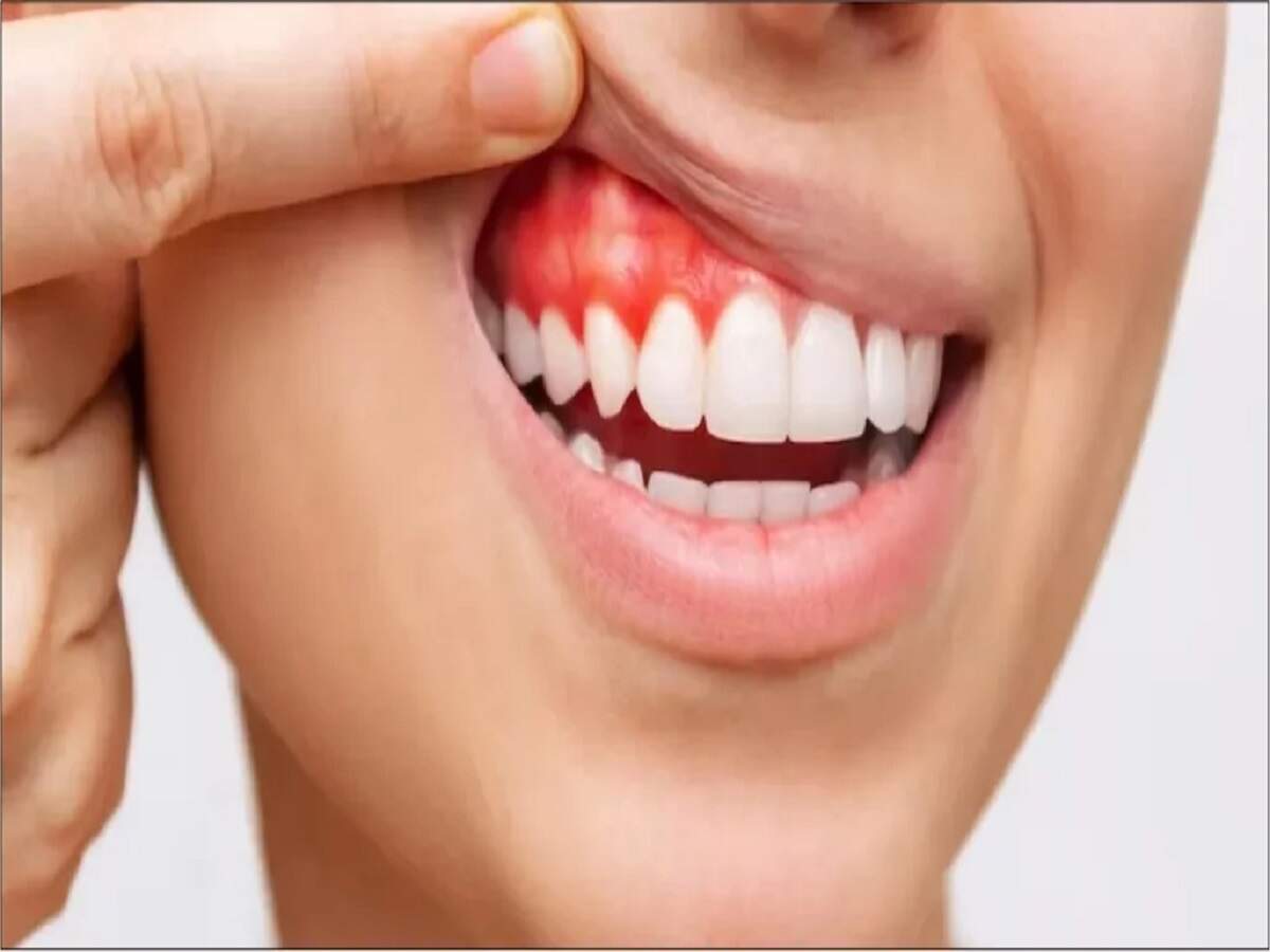 Health Tips: Mouth ulcers can cause ear pain—find out why.