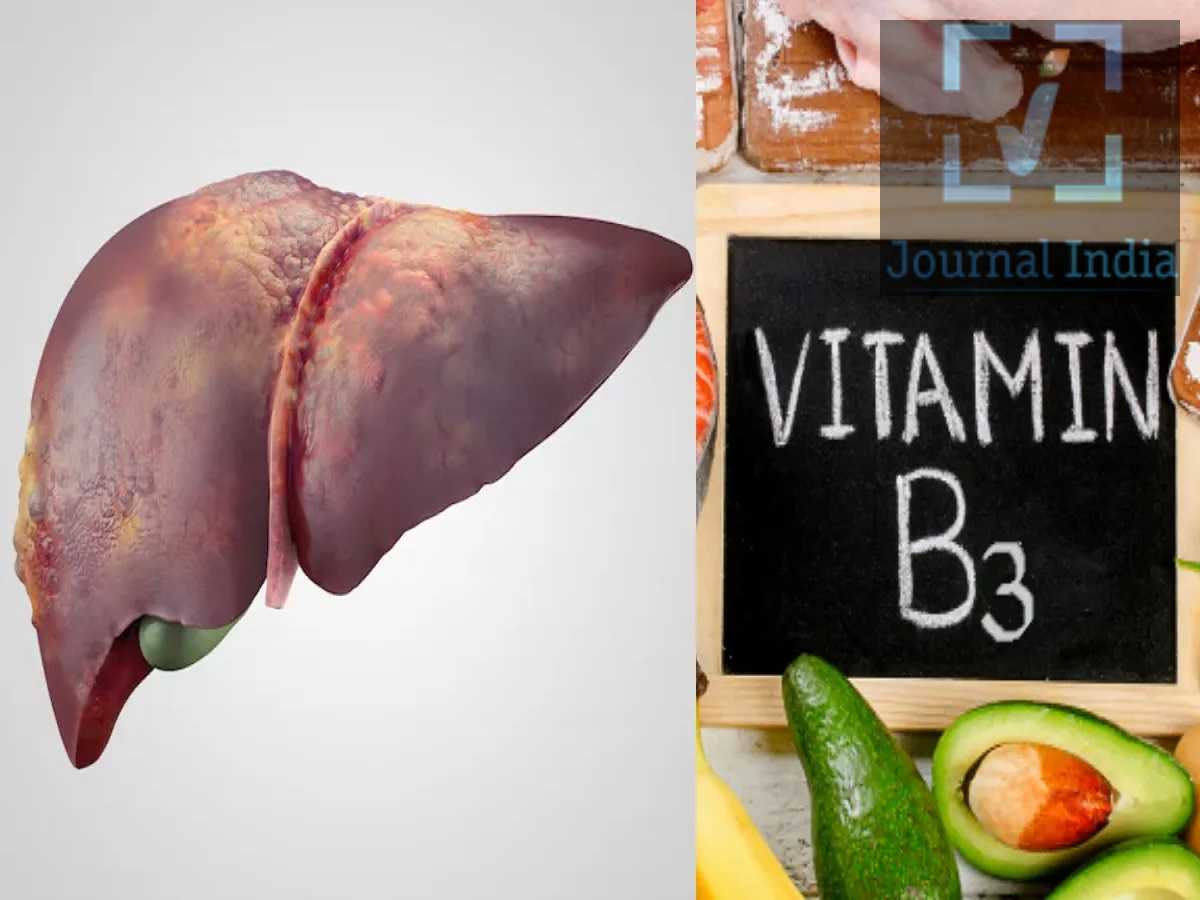 Fatty Liver