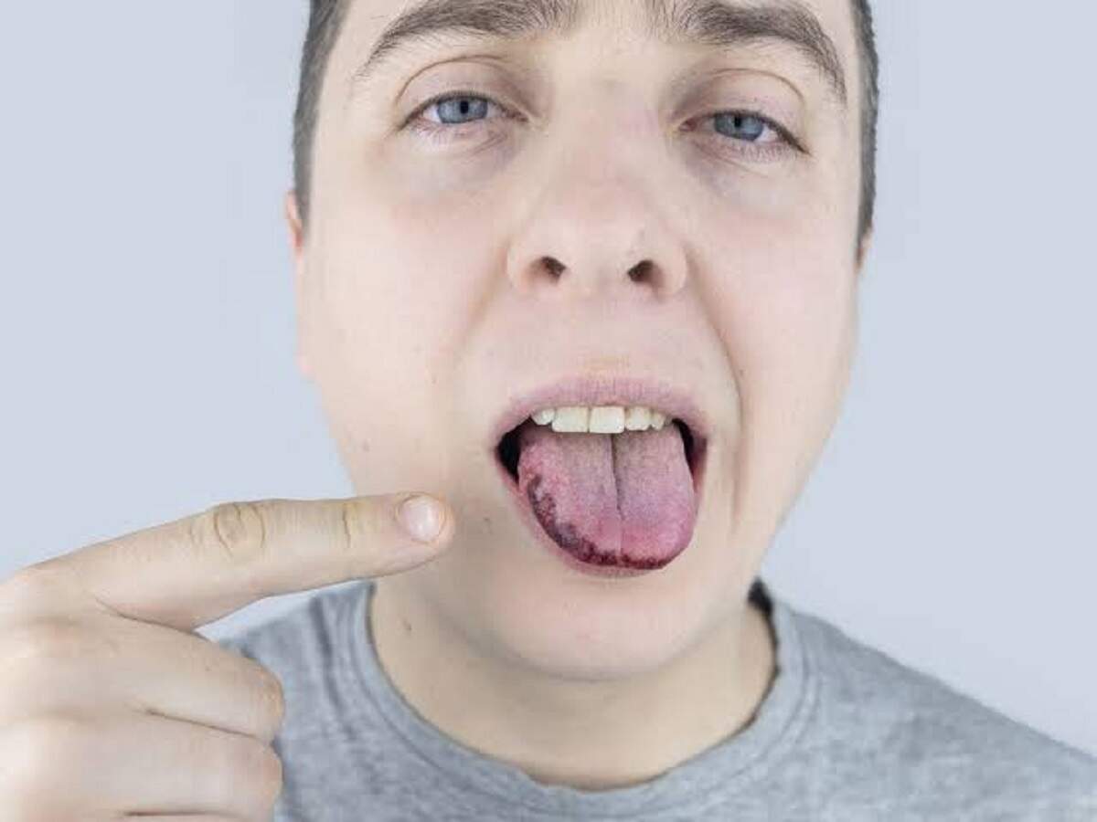 Health Tips- क्या खाना खाते वक्त बार बार कट रही है जीभ, जानिए इसकी वजह