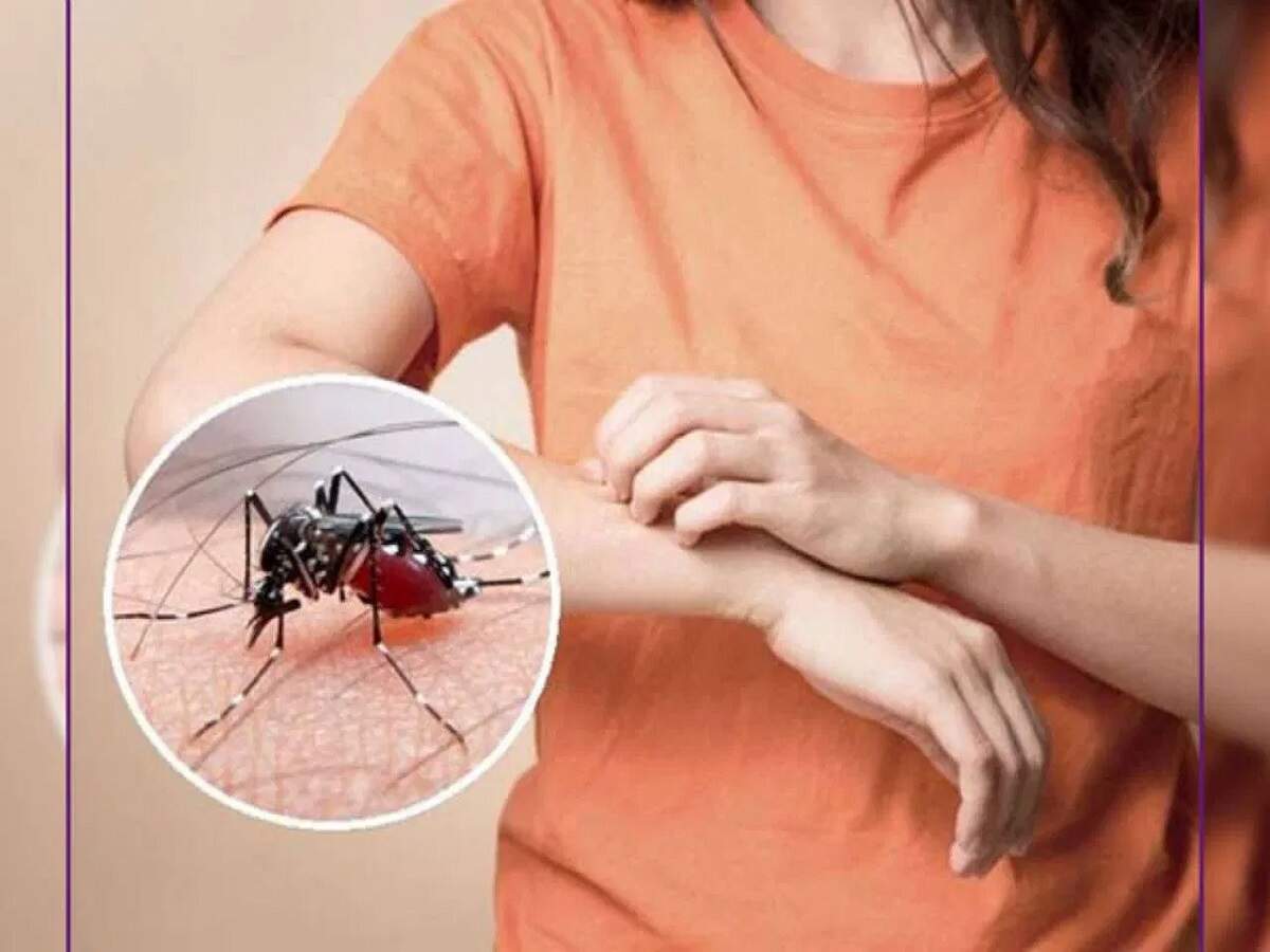 Monsoon Tips: Troubled by mosquitoes? Follow these simple and effective ways to stay safe.
