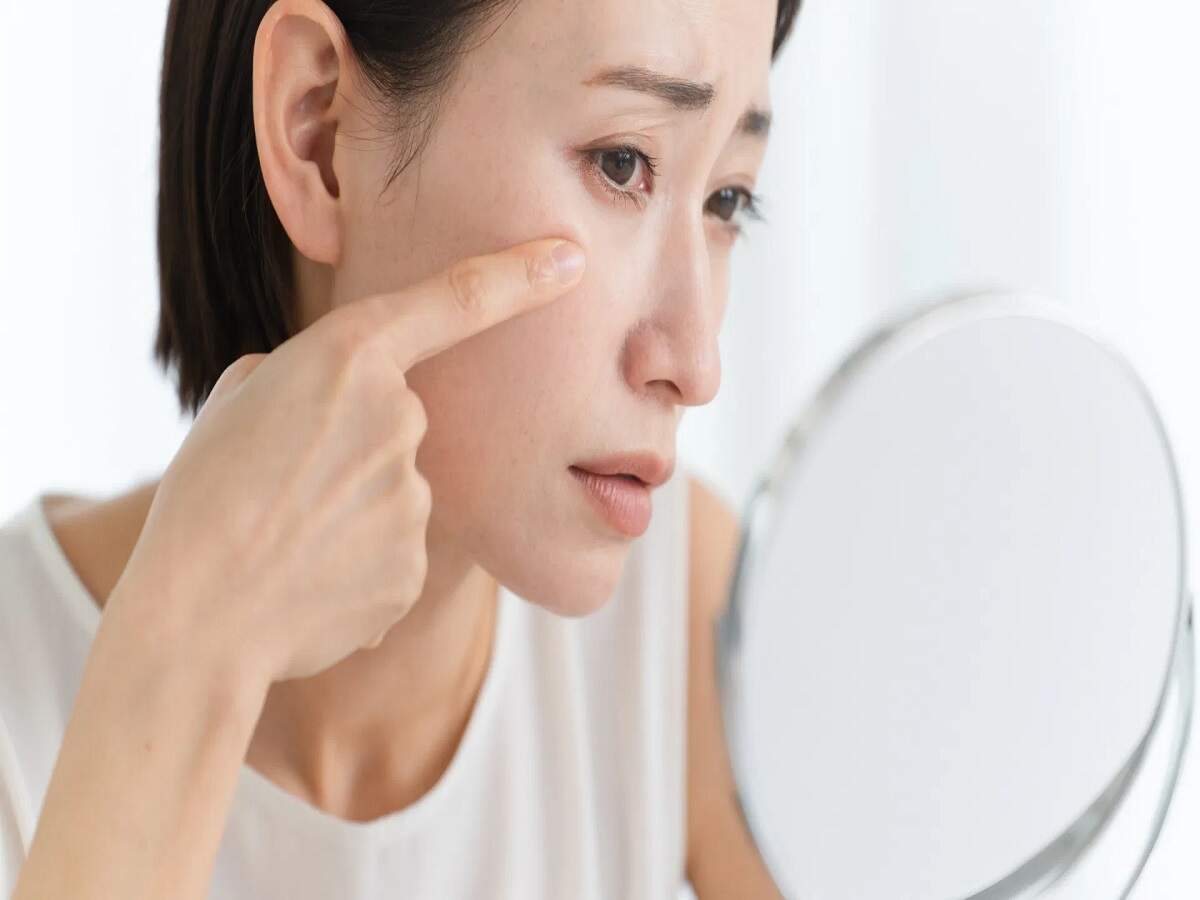 Skin Care Tips: People with oily skin should use moisturizer—find out what experts say.