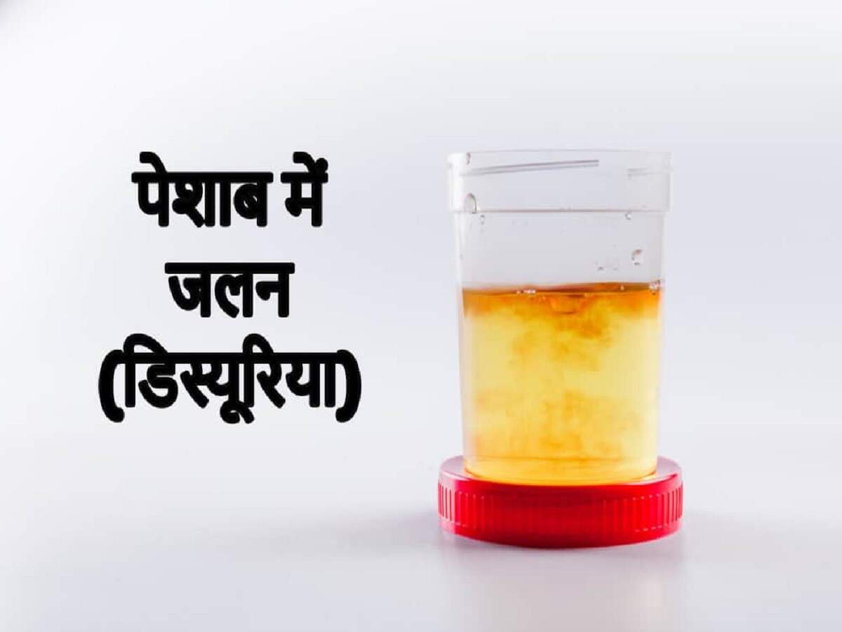 UTI Problem – Are you experiencing a burning sensation while urinating? Could this be a health issue?
