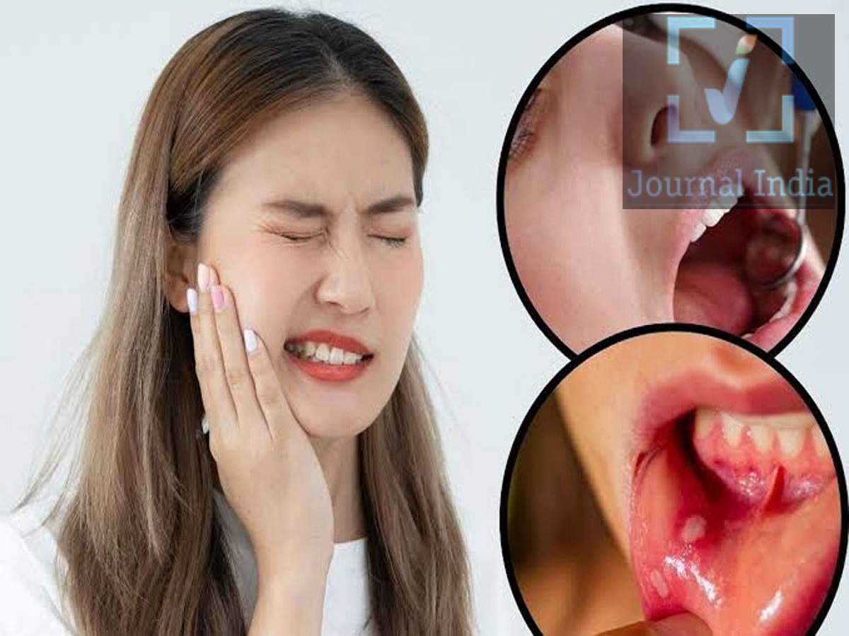 Health Tips- क्या खाना खाते वक्त बार बार कट रही है जीभ, जानिए इसकी वजह दोस्तो हम सबके साथ ऐसा होता हैं कि जब हम खाना खाते है जो जीभ कट जाती है, ऐसा कभी कभी होना एक आम बात हैं, लेकिन अगर ऐसा बार बार हो रहा हैं, तो तो यह आपके दाँतों, जीभ की सूजन या मुँह के स्वास्थ्य से जुड़ी किसी समस्या का संकेत हो सकता हैं, जीभ खाना चबाने, निगलने और बोलने में अहम भूमिका निभाती है। जीभ पर बार-बार चोट लगने से दर्द, सूजन हो सकती है और खाते समय परेशानी हो सकती है। आइए जानते हैं इसके मुख्य कारणों के बारे में-  1. नुकीले या टेढ़े-मेढ़े दाँत आपके दाँतों का आकार और उनकी बनावट जीभ पर बार-बार चोट लगने का कारण बन सकती है। टूटे हुए दाँत, नुकीले किनारे, टेढ़े-मेढ़े दाँत या ठीक से न भरी गई डेंटल फिलिंग की वजह से खाना चबाते समय गलती से जीभ कट सकती है या दब सकती है। - देखें कि क्या कोई खास दाँत बार-बार चोट लगने का कारण बन रहा है। - अगर आपकी जीभ का एक ही हिस्सा बार-बार कटता है, तो डेंटिस्ट (दाँतों के डॉक्टर) से सलाह लें। - नुकीले दाँतों को खुद घिसकर या चिकना करने की कोशिश न करें। 2. जीभ में सूजन सूजी हुई जीभ मुँह के अंदर ज़्यादा जगह घेरती है, जिससे खाते समय इसके कटने का खतरा बढ़ जाता है। सूजन किसी चोट, संक्रमण, एलर्जी या किसी अन्य मेडिकल स्थिति के कारण हो सकती है। अगर आपकी जीभ में अचानक सूजन आ जाए, खासकर गले में सूजन हो या साँस लेने या कुछ निगलने में दिक्कत हो, तो तुरंत इमरजेंसी मेडिकल मदद लें। 3. विटामिन और आयरन की कमी शरीर में पोषक तत्वों की कमी का असर जीभ के स्वास्थ्य पर पड़ सकता है। विटामिन B12, फोलेट या आयरन की कमी से जीभ में दर्द, जलन या जीभ के रूप-रंग में बदलाव हो सकता है।  जीभ का बार-बार कटना हमेशा पोषक तत्वों की कमी का ही संकेत नहीं होता है। अगर आपको मुँह में लगातार दर्द, कमज़ोरी, थकान या जलन महसूस होती है, तो सही जाँच के लिए डॉक्टर से सलाह लें। 4. बहुत जल्दी खाना या ध्यान कहीं और होना जल्दी-जल्दी खाना खाने, चबाते समय बात करने या बिना ध्यान दिए खाना खाने से जीभ कटने का खतरा बढ़ सकता है। इस खतरे को कम करने के लिए: - धीरे-धीरे खाएँ और अपने खाने को अच्छी तरह चबाएँ। - खाना चबाते समय बात करने से बचें। - छोटे-छोटे निवाले लें और खाते समय पूरा ध्यान खाने पर रखें। - अगर इन सावधानियों के बावजूद जीभ कटती रहती है, तो डेंटिस्ट से जाँच करवाएँ। 5. अगर गलती से आपकी जीभ कट जाए तो क्या करें जीभ पर लगी मामूली चोट को अक्सर साधारण प्राथमिक उपचार (फर्स्ट एड) से ठीक किया जा सकता है। - अपना मुँह धोएं: साफ पानी से धीरे-धीरे कुल्ला करें। - खून बहने से रोकें: अगर चोट वाली जगह तक पहुंचना आसान है, तो साफ जालीदार कपड़े (गॉज) से वहां हल्का और लगातार दबाव डालें। - सूजन कम करें: बाहर से ठंडा सेंक (कोल्ड कंप्रेस) लगाएं, या अगर आप बिना किसी परेशानी के कर सकें, तो बर्फ का एक छोटा टुकड़ा चूसें। - जलन पैदा करने वाली चीजों से बचें: जब तक घाव ठीक न हो जाए, तब तक बहुत गर्म, तीखी, खट्टी या सख्त चीजों से दूर रहें। - जरूरत पड़ने पर डॉक्टर को दिखाएं: अगर घाव गहरा है, खून बहना बंद नहीं हो रहा है, सूजन बहुत ज्यादा है, या दर्द की वजह से खाने-पीने में दिक्कत हो रही है, तो किसी डॉक्टर से सलाह लें। अगर आपको सांस लेने में या लार निगलने में दिक्कत हो रही है, तो तुरंत आपातकालीन चिकित्सा सहायता लें।
