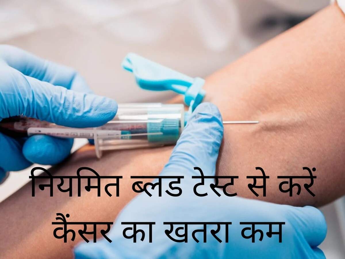 Health Tips: Can regular CBC tests protect us from blood cancer? Let's find out.