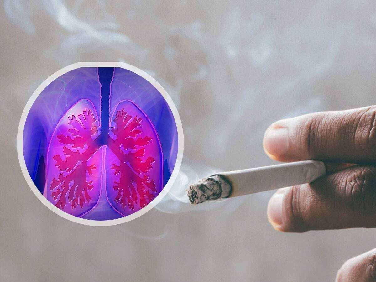 Health Tips – These people should definitely undergo lung cancer screening; find out why.