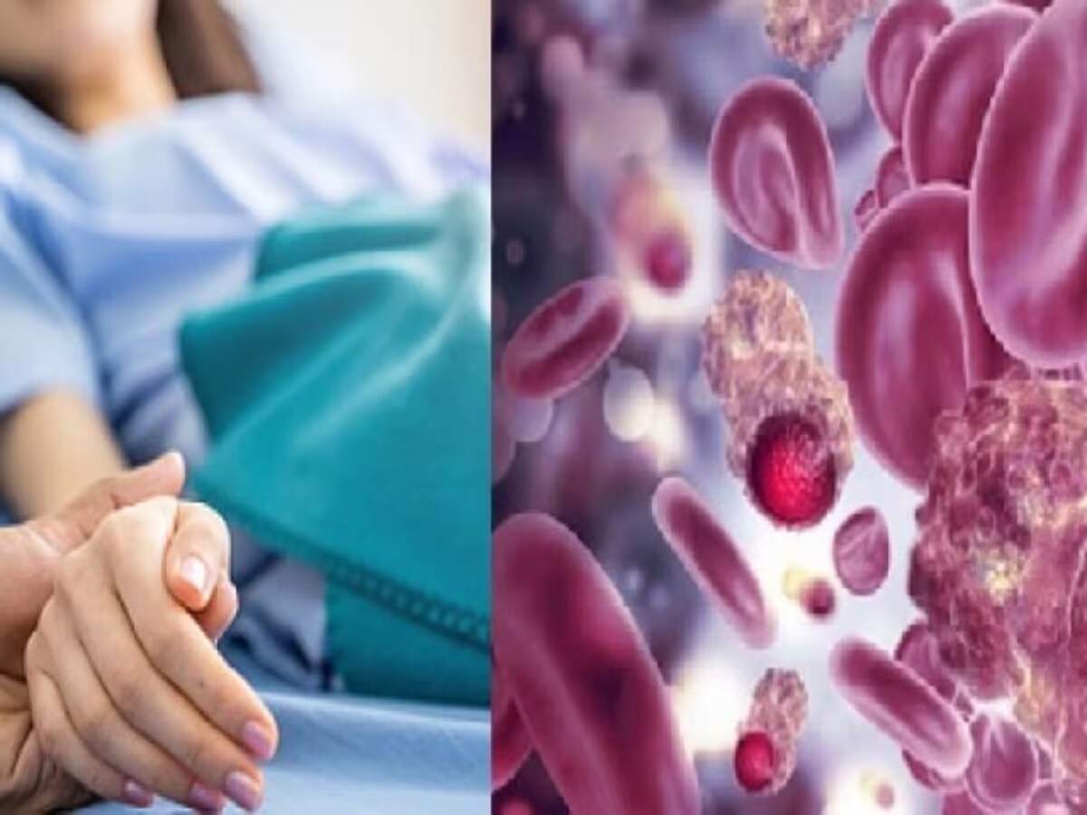 Health Tips: Can regular CBC tests protect us from blood cancer? Let's find out.