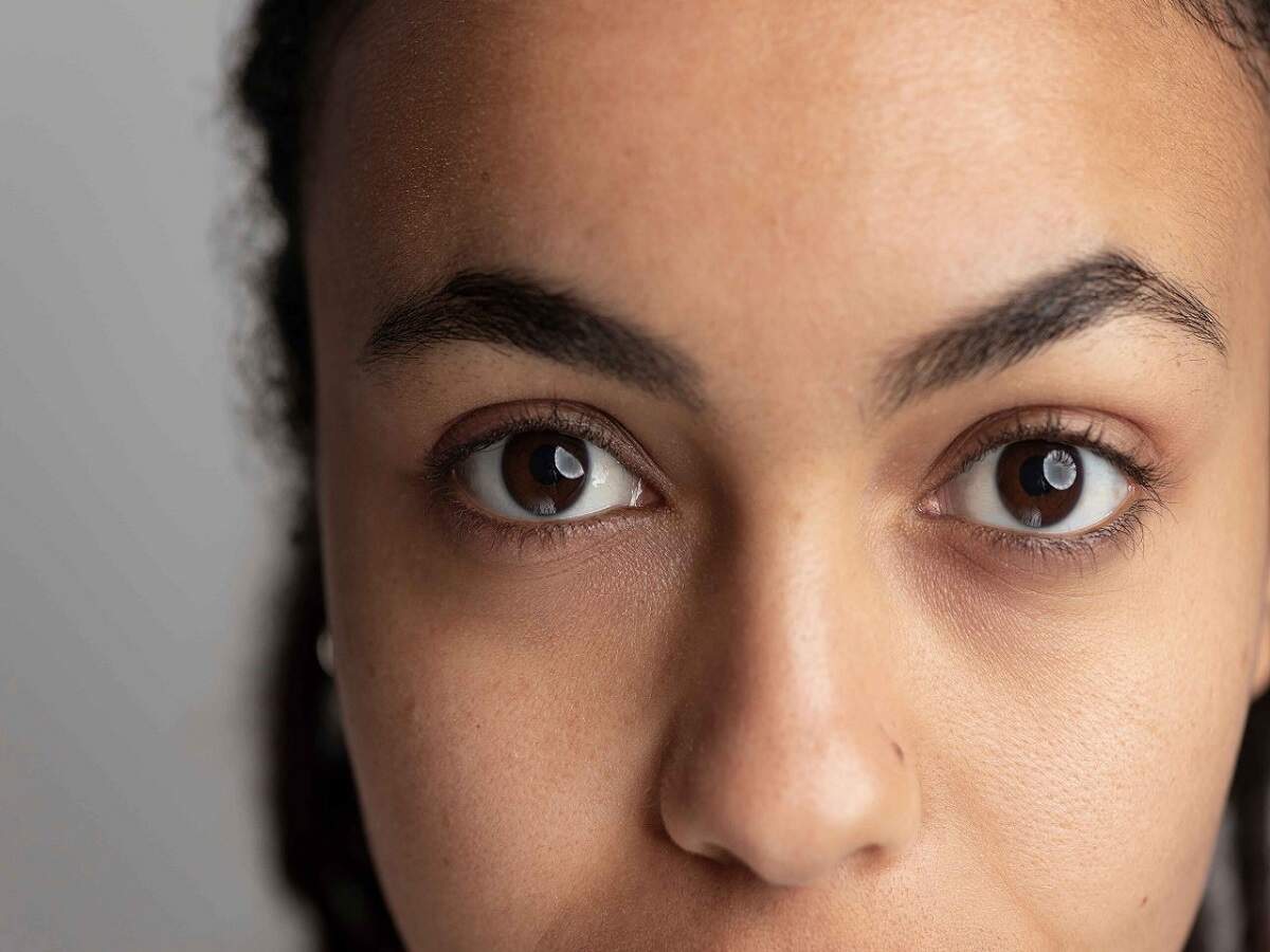 Eye Care Tips – Do you have dark circles under your eyes? Let’s find out the reasons behind them.